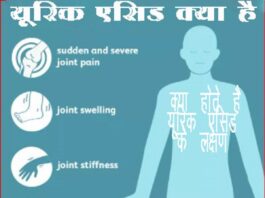 क्या आप भी यूरिक एसिड की परेशानी से जूझ रहे हैं? (How to Control Uric Acid at Home) यूरिक एसिड क्या है