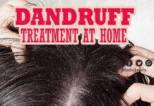 डैंड्रफ का घरेलु इलाज़ (Dandruff Treatment at Home)