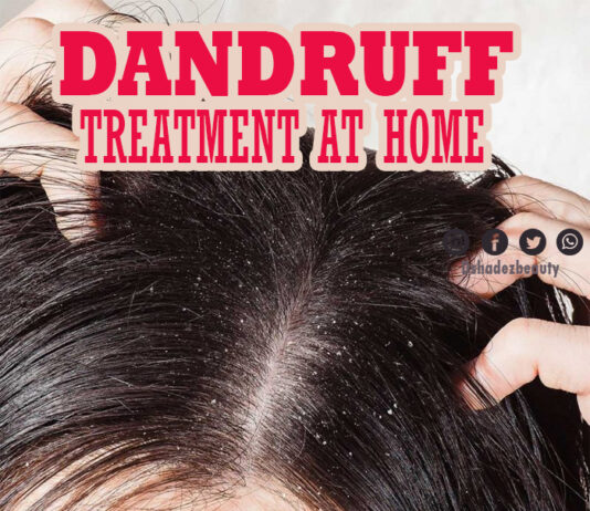 डैंड्रफ का घरेलु इलाज़ (Dandruff Treatment at Home)