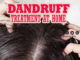 डैंड्रफ का घरेलु इलाज़ (Dandruff Treatment at Home)