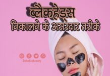 ब्लैकहेड्स निकालने के असरदार तरीके (Best Blackhead Removing Techniques) Best Blackhead Removing Techniques
