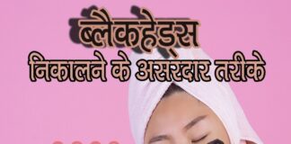 ब्लैकहेड्स निकालने के असरदार तरीके (Best Blackhead Removing Techniques) Best Blackhead Removing Techniques
