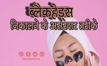 ब्लैकहेड्स निकालने के असरदार तरीके (Best Blackhead Removing Techniques) Best Blackhead Removing Techniques
