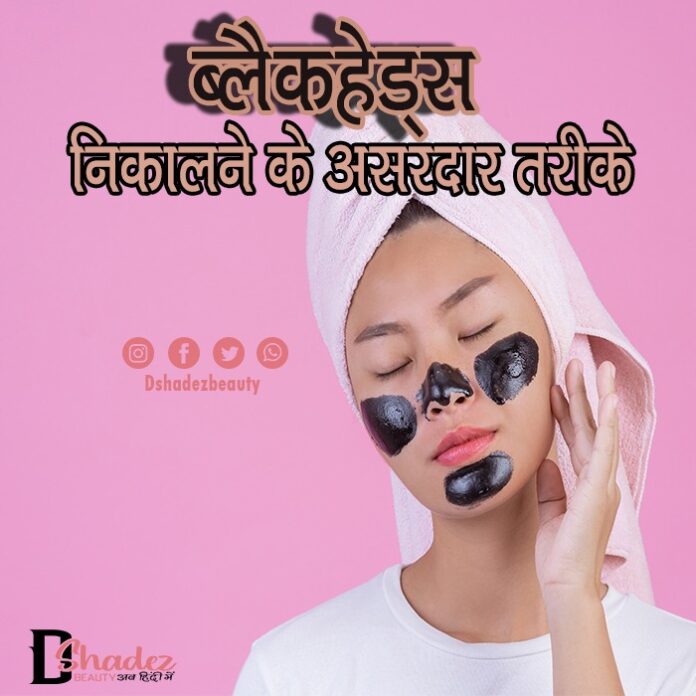 Best Blackhead Removing Techniques