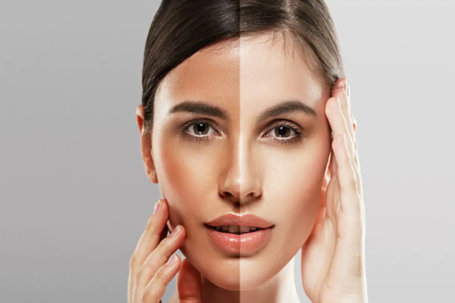 All About Skin whitening
