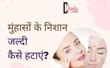 मुंहासों के निशान जल्दी कैसे हटाएं? – How to Remove Acne Scars how to remove acne scars