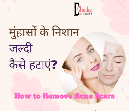 मुंहासों के निशान जल्दी कैसे हटाएं? – How to Remove Acne Scars how to remove acne scars