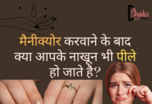 पीले नाखूनों से कैसे छुटकारा पाएं? – Yellow Nails After Nail Polish Yellow Nails After Nail Polish