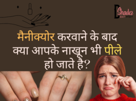 पीले नाखूनों से कैसे छुटकारा पाएं? – Yellow Nails After Nail Polish Yellow Nails After Nail Polish