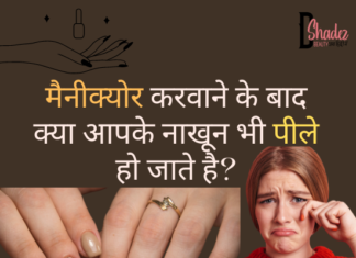 पीले नाखूनों से कैसे छुटकारा पाएं? – Yellow Nails After Nail Polish Yellow Nails After Nail Polish