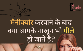 पीले नाखूनों से कैसे छुटकारा पाएं? – Yellow Nails After Nail Polish Yellow Nails After Nail Polish