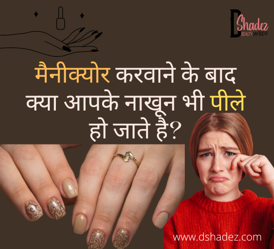 पीले नाखूनों से कैसे छुटकारा पाएं? - Yellow Nails After Nail Polish - Dshadez पीले नाखूनों से कैसे छुटकारा पाएं? - Yellow Nails After Nail Polish - Dshadez