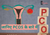 जानिए PCOS के बारे में- PCOS Symptoms, Cause and Treatment Pcos symptoms cause and treatment