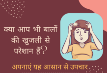 बालों की खुजली रोकने के घरेलु उपाय- Scalp Itching Treatment scalp itching treatment