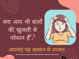 बालों की खुजली रोकने के घरेलु उपाय- Scalp Itching Treatment scalp itching treatment