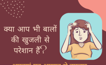 बालों की खुजली रोकने के घरेलु उपाय- Scalp Itching Treatment scalp itching treatment