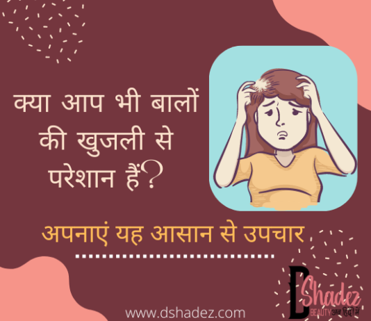 बालों की खुजली रोकने के घरेलु उपाय- Scalp Itching Treatment scalp itching treatment