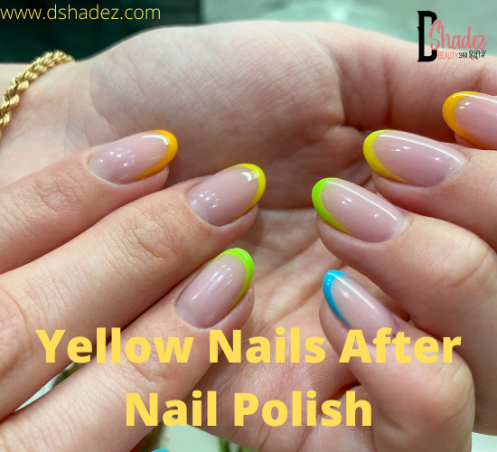 Yellow Nails After Nail Polish